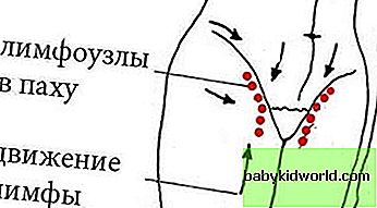 Слева в паху у мужчин. Где находятся лимфоузлы в паху. Лимфоузлы в паху расположение. Паховые лимфатические узлы у женщин. Лимфоузлы в паху у женщин где.