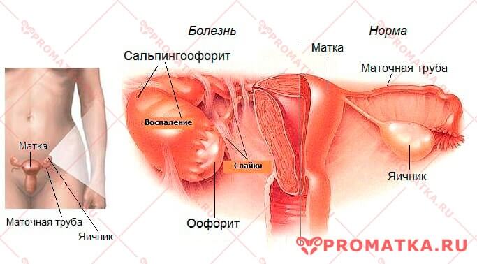 Где находятся яичники картинки